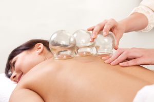 Patient receives cupping therapy on her back